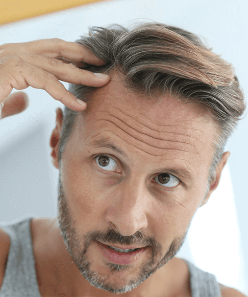 Hair Loss Treatment in Chicago, Illinois | Giostar Chicago