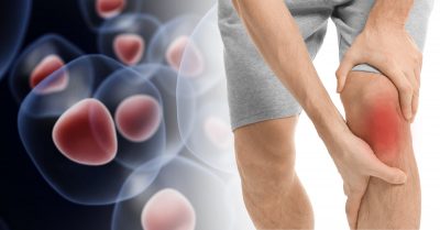 Stem Cell Therapy for Knees