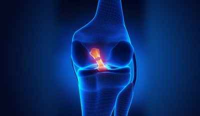 Can an ACL Tear Heal Without Surgery?