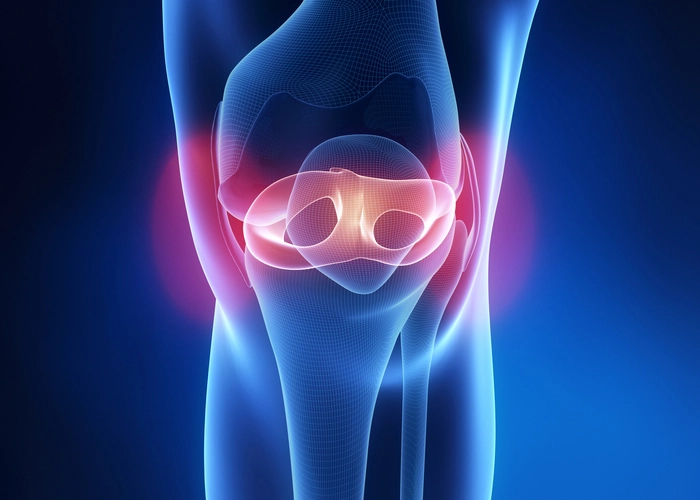 Radial Lateral Meniscus Tears