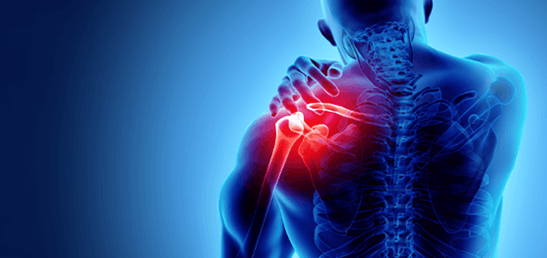 is there an alternative to shoulder replacement surgery