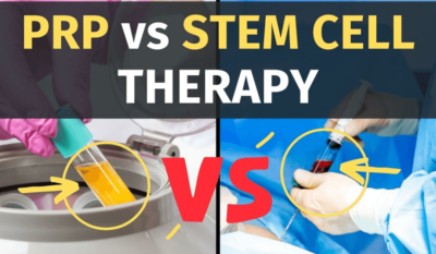 Which is better PRP or stem cell therapy