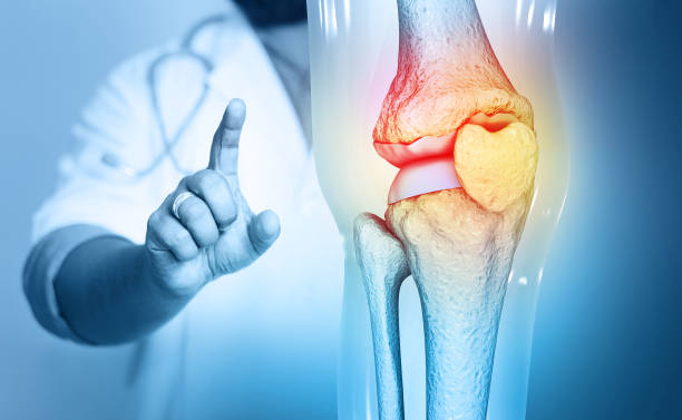 What I Wish I Knew Before Knee Replacement Surgery 2